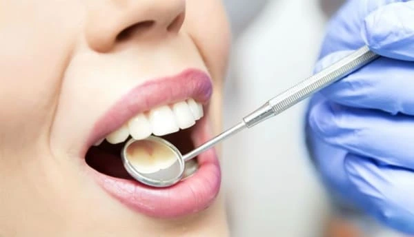 Check-up dental